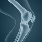 imagem destaque elipse infiltração intra-articular