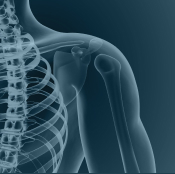 imagem destaque elipse infiltração periarticular